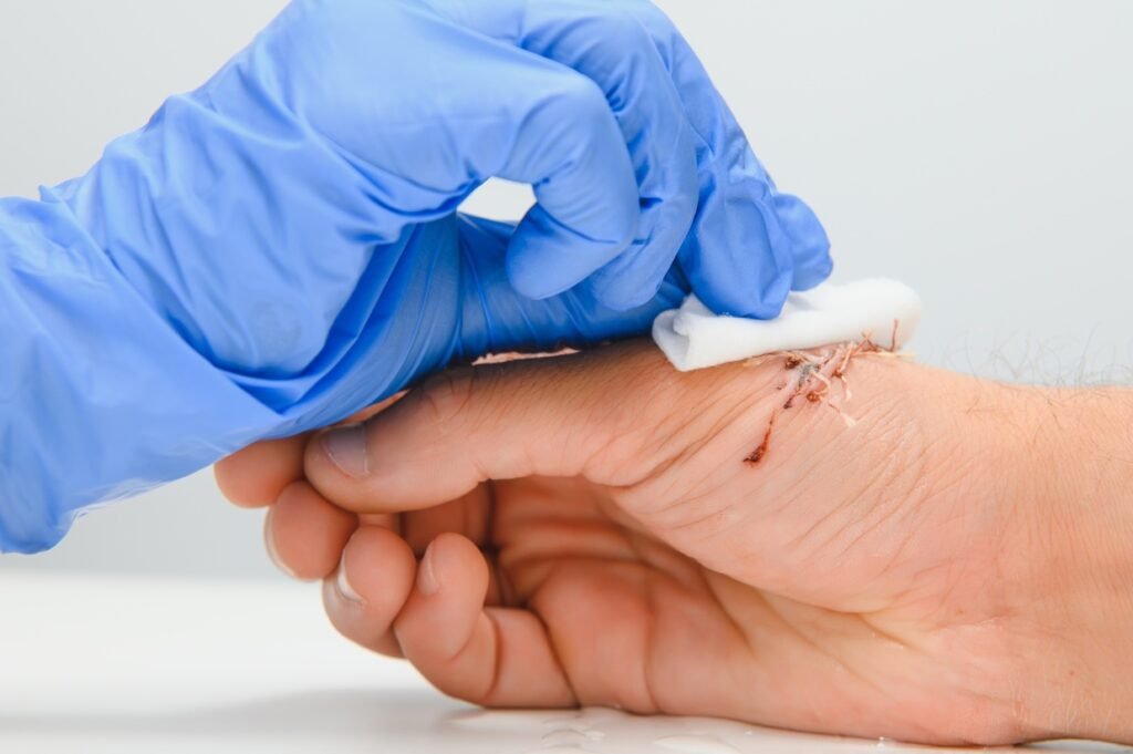 wound care