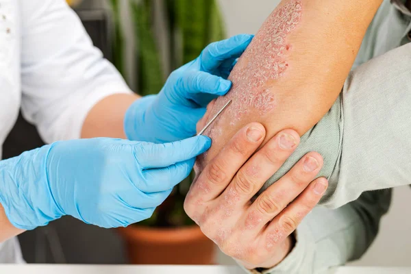 Skin scrapping