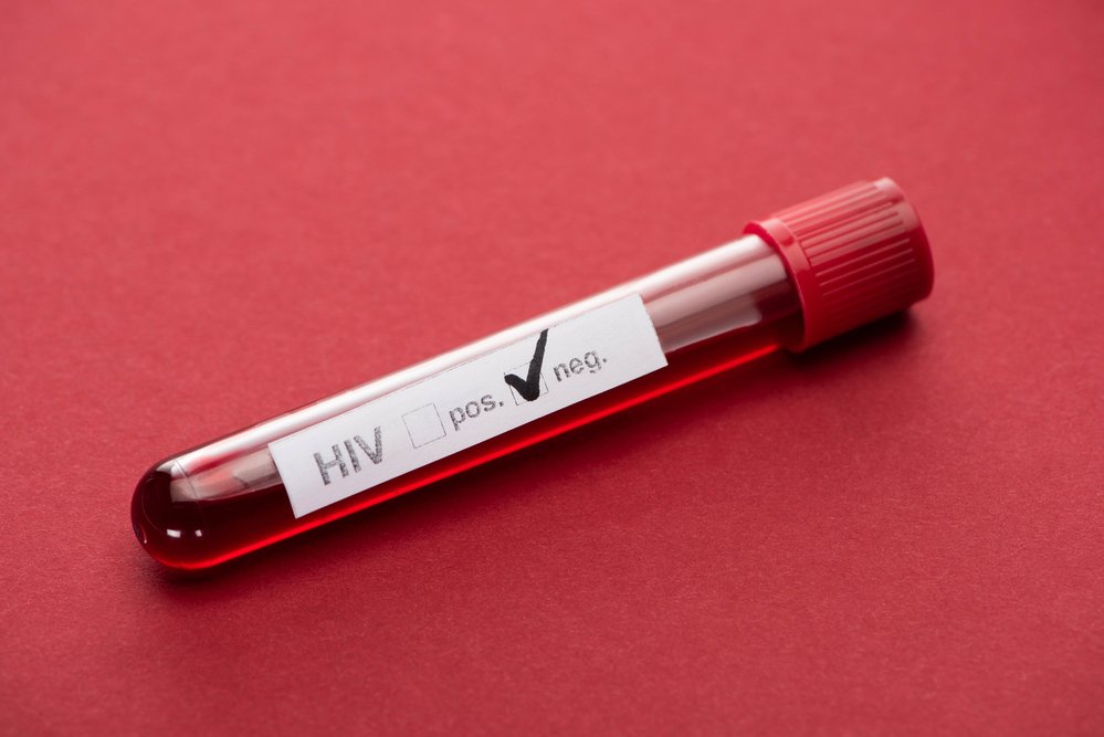 blood sample vial hiv test