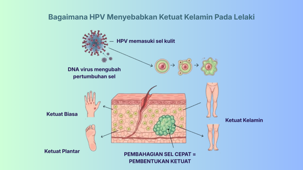 hpv infographic malay